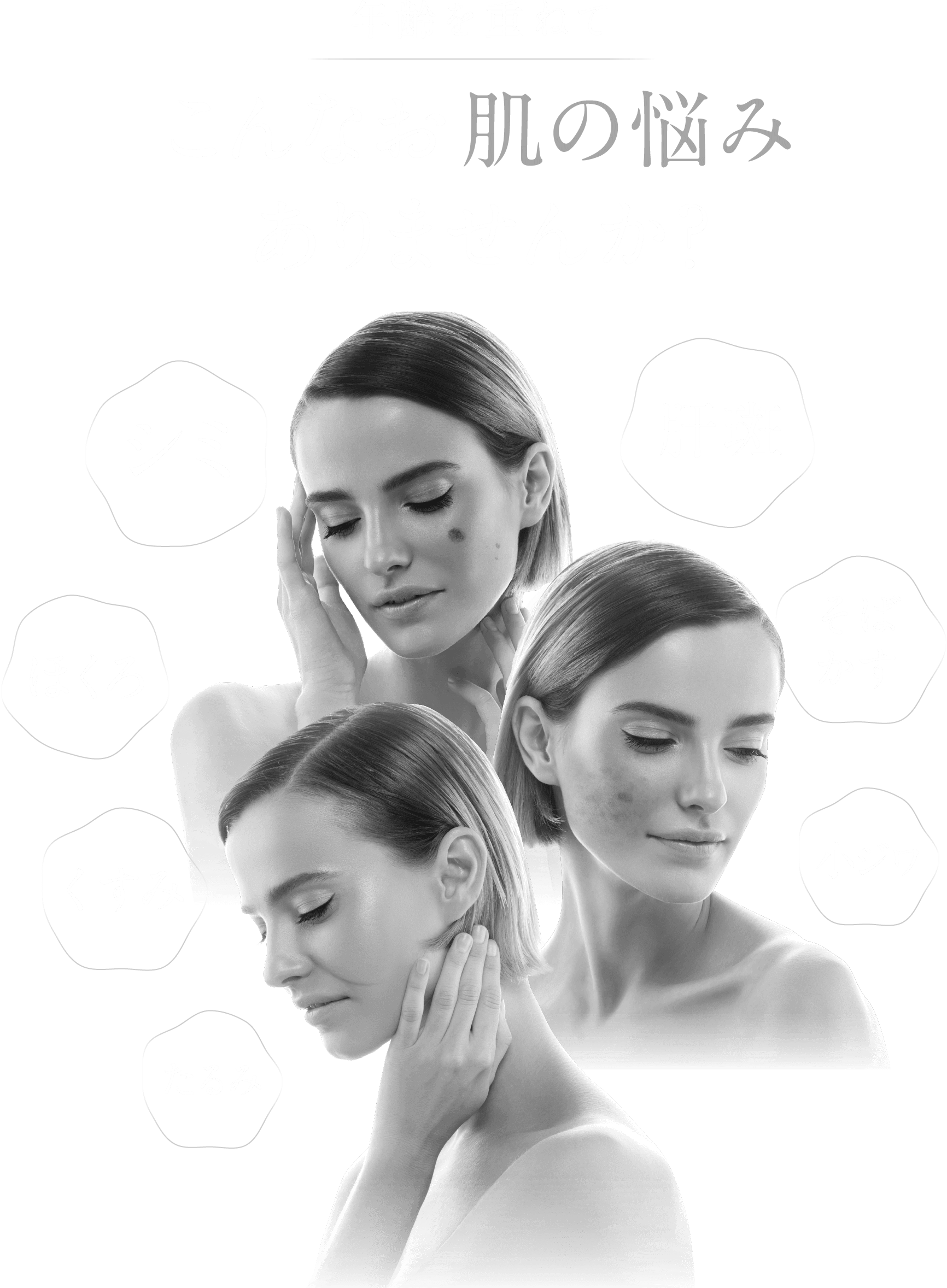 年齢を重ねてこんなお肌の悩みありませんか？そばかすほくろくすみ小ジワたるみ肝斑シミ