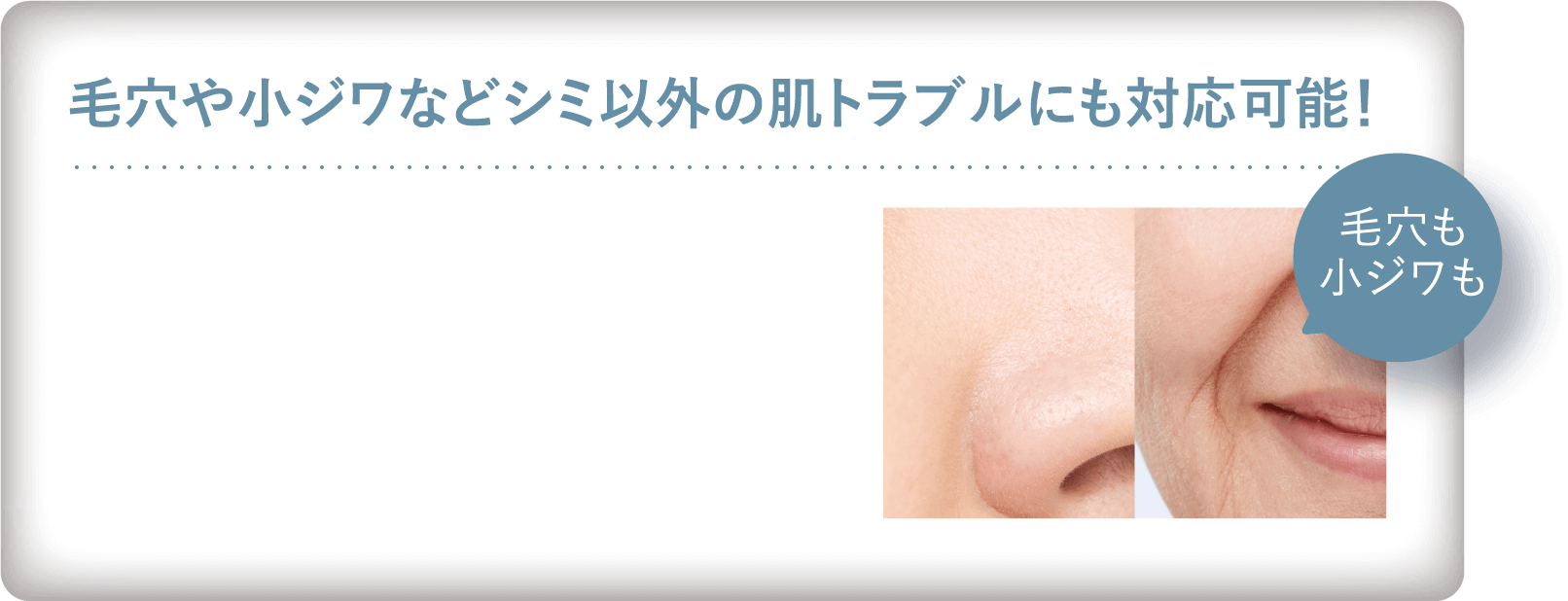 毛穴も 小ジワも毛穴や小ジワなどシミ以外の肌トラブルにも対応可能！