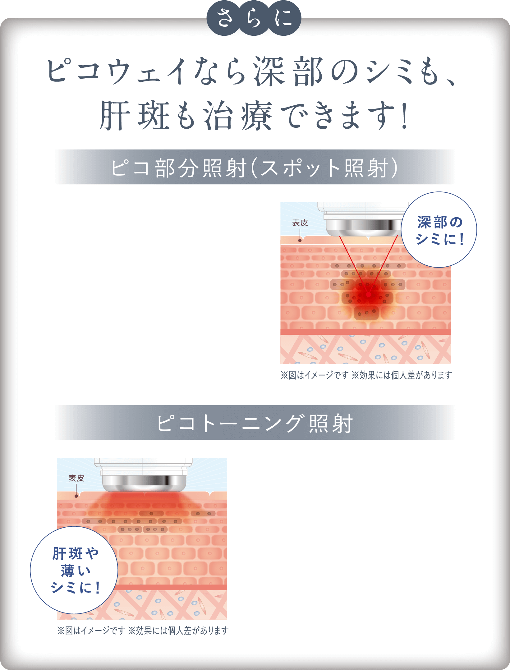 ※図はイメージです ※効果には個人差があります※図はイメージです ※効果には個人差があります深部のシミに！ピコウェイなら深部のシミも､肝斑も治療できます！肝斑や薄いシミに！さらにピコトーニング照射ピコ部分照射(スポット照射)